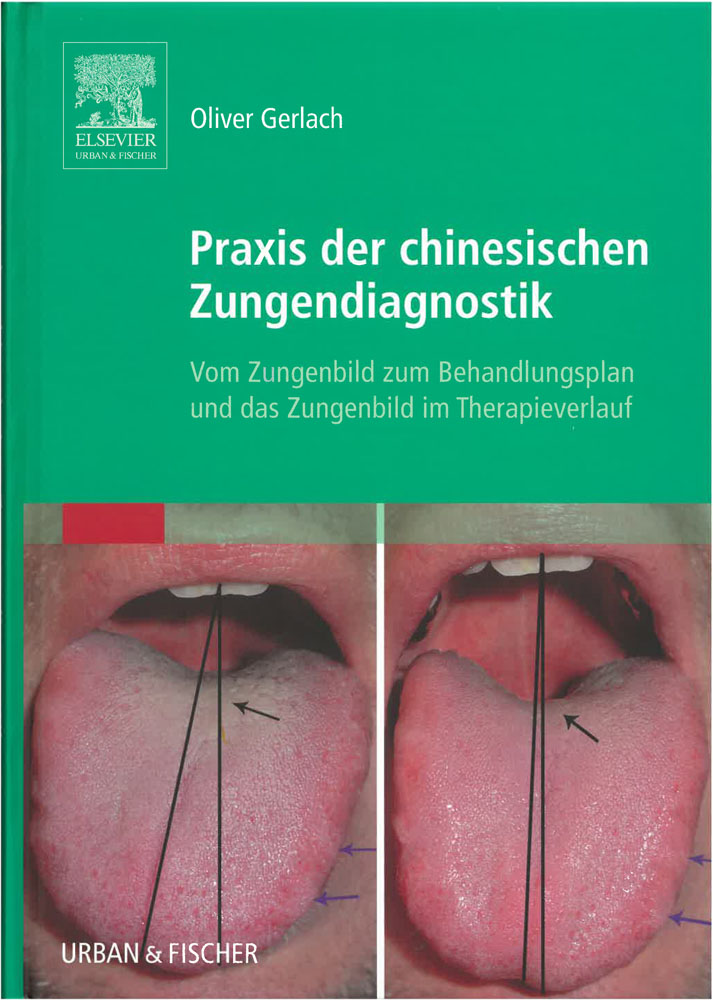 Praxis der chinesischen Zungendiagnostik 
