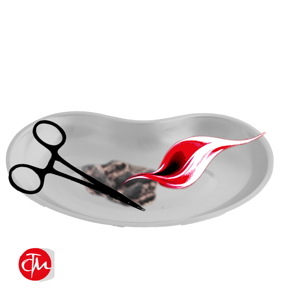 Moxazubehör / Werkzeuge für Moxa / Moxautensilien